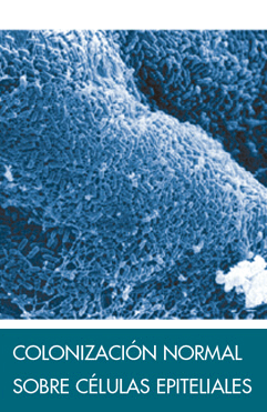 microbiota-protectora-colonizacion-normal-celulasepitelialies-glosario-ime